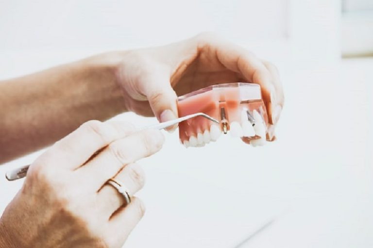 Some Dental Procedures You Need to Know
