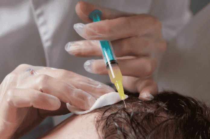 CRP Hair Loss Treatment Session