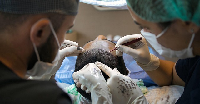 Doctors performing a hair restoration procedure on a man to highlight the importance of managing expectations with men’s hair loss treatments